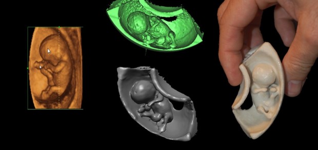 Model 12-tygodniowego dziecka otrzymany dzięki technice druku 3D, fot. lifenews.com