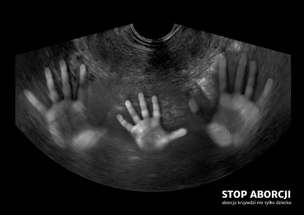 Łukasz Piekorz, Stop aborcji - aborcja krzywdzi nie tylko dziecko